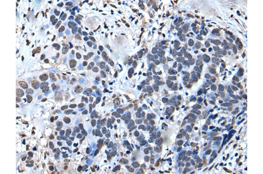 GTF2H1 Antibody from Signalway Antibody (43644) - Antibodies.com