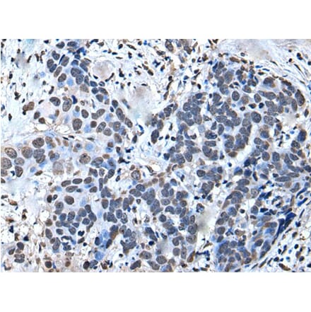 GTF2H1 Antibody from Signalway Antibody (43644) - Antibodies.com