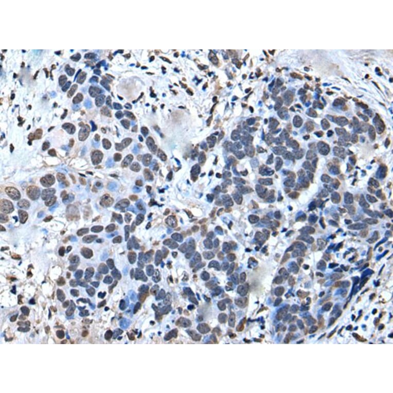 GTF2H1 Antibody from Signalway Antibody (43644) - Antibodies.com