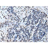 GTF2H1 Antibody from Signalway Antibody (43644) - Antibodies.com