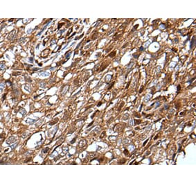 MLXIPL Antibody from Signalway Antibody (43648) - Antibodies.com