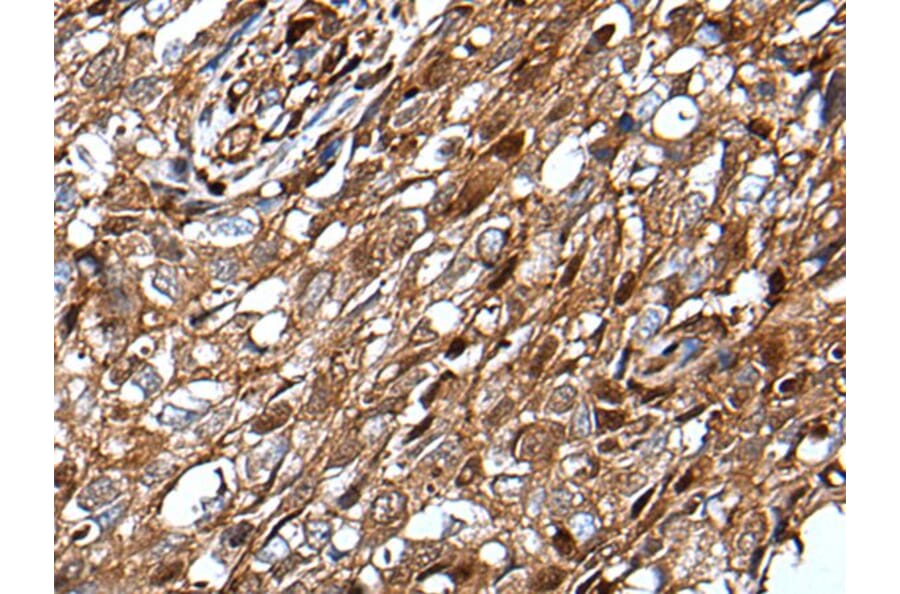 MLXIPL Antibody from Signalway Antibody (43648) - Antibodies.com