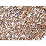 MLXIPL Antibody from Signalway Antibody (43648) - Antibodies.com