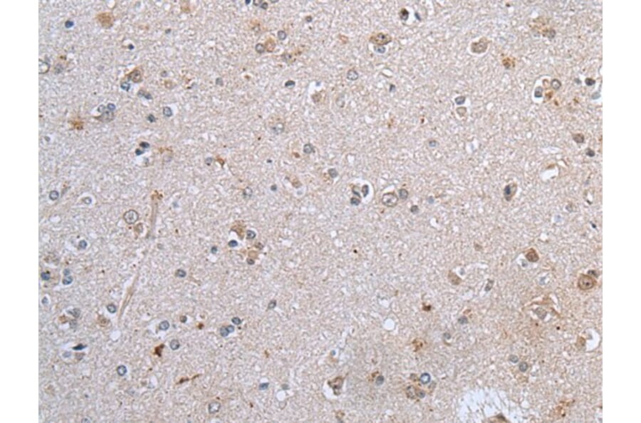 CLDN12 Antibody from Signalway Antibody (43652) - Antibodies.com