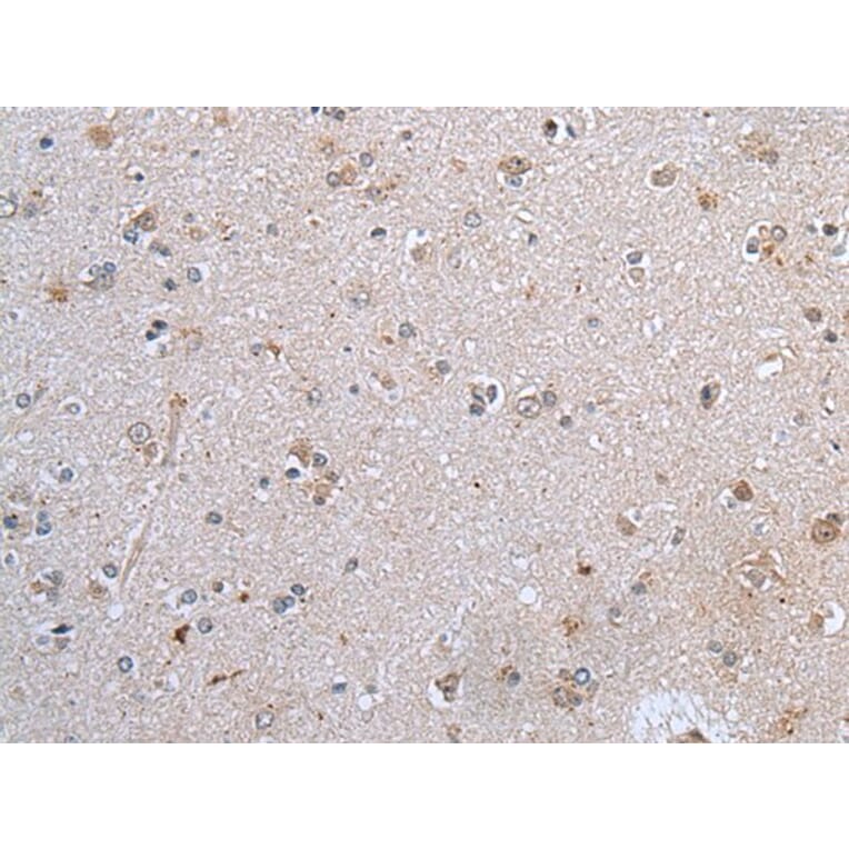 CLDN12 Antibody from Signalway Antibody (43652) - Antibodies.com