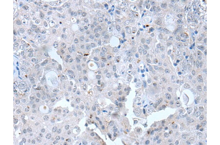 CLDN12 Antibody from Signalway Antibody (43652) - Antibodies.com