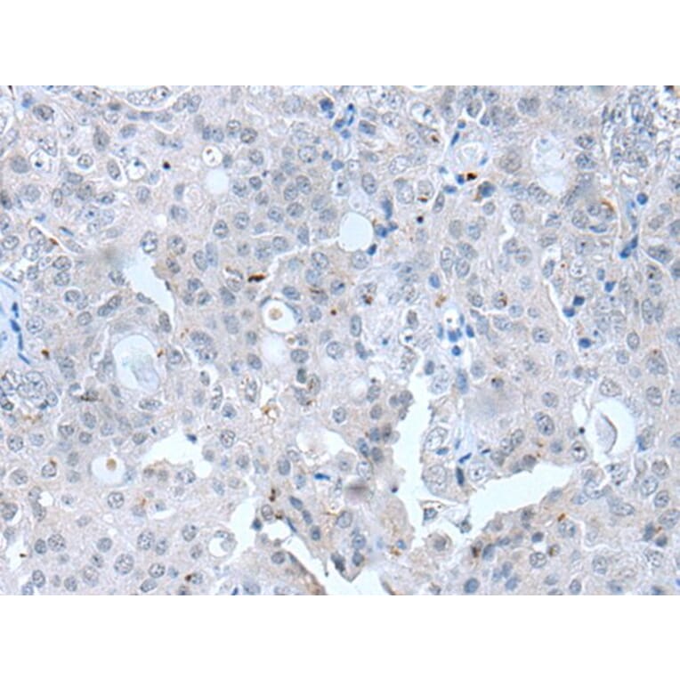 CLDN12 Antibody from Signalway Antibody (43652) - Antibodies.com
