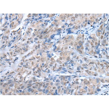 TMEM97 Antibody from Signalway Antibody (43655) - Antibodies.com