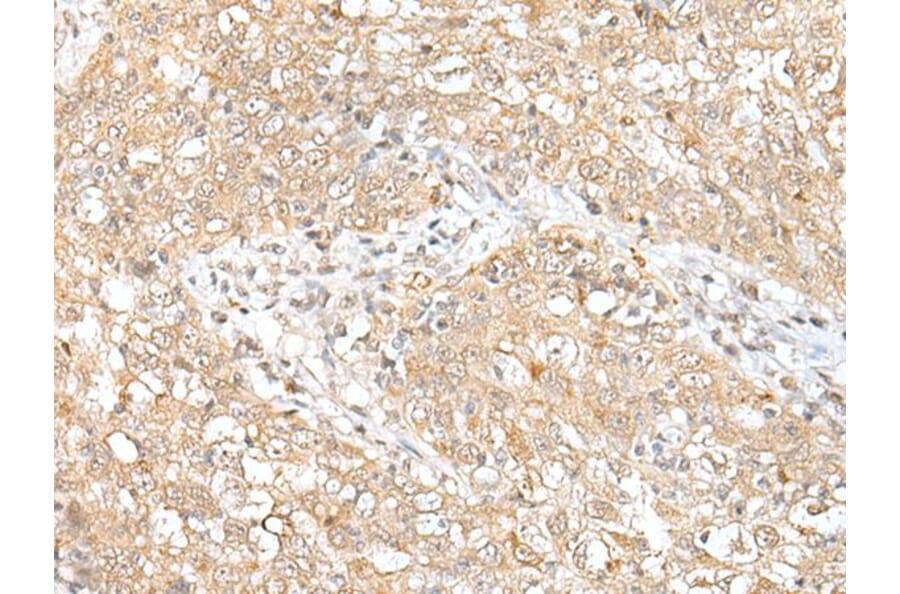 CHRNB2 Antibody from Signalway Antibody (43662) - Antibodies.com