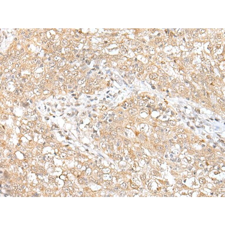 CHRNB2 Antibody from Signalway Antibody (43662) - Antibodies.com