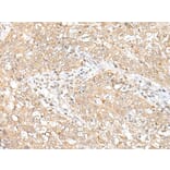 CHRNB2 Antibody from Signalway Antibody (43662) - Antibodies.com