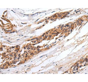 GABRR2 Antibody from Signalway Antibody (43672) - Antibodies.com