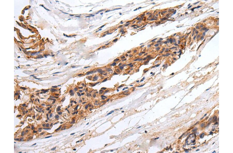 GABRR2 Antibody from Signalway Antibody (43672) - Antibodies.com