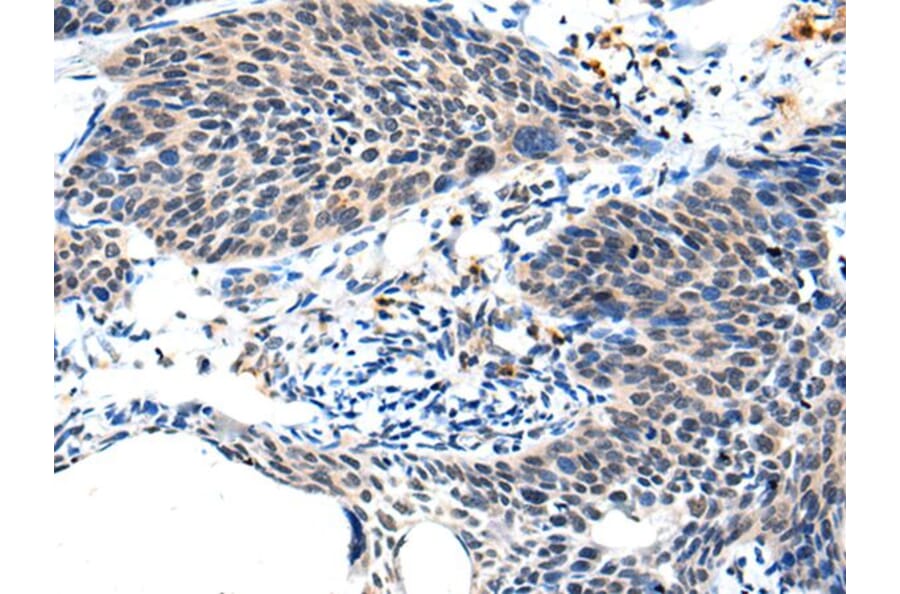 ALS2CL Antibody from Signalway Antibody (43697) - Antibodies.com