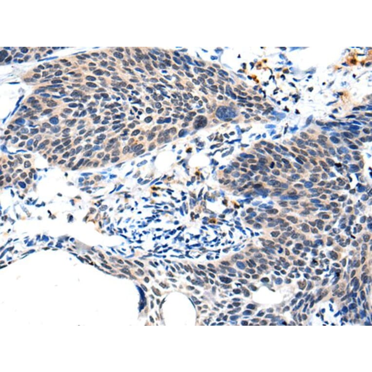 ALS2CL Antibody from Signalway Antibody (43697) - Antibodies.com
