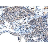 ALS2CL Antibody from Signalway Antibody (43697) - Antibodies.com