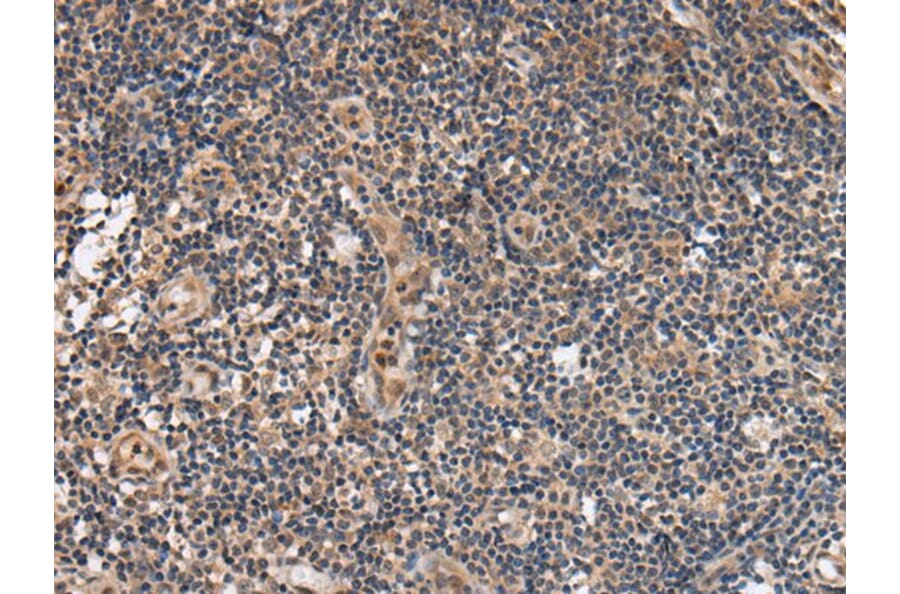 ALS2CL Antibody from Signalway Antibody (43697) - Antibodies.com