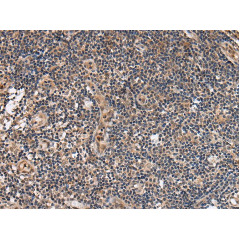 ALS2CL Antibody from Signalway Antibody (43697) - Antibodies.com