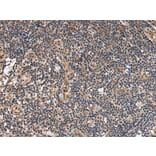 ALS2CL Antibody from Signalway Antibody (43697) - Antibodies.com