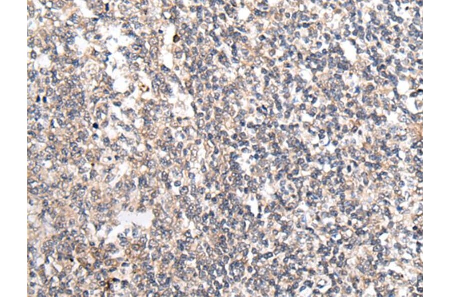 MT-ND5 Antibody from Signalway Antibody (43708) - Antibodies.com