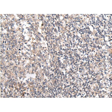 MT-ND5 Antibody from Signalway Antibody (43708) - Antibodies.com