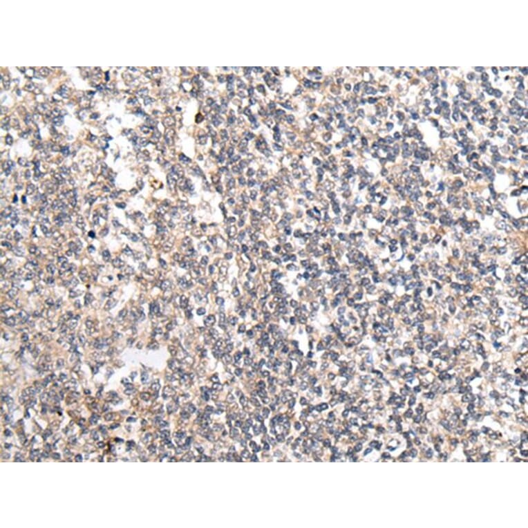 MT-ND5 Antibody from Signalway Antibody (43708) - Antibodies.com