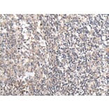 MT-ND5 Antibody from Signalway Antibody (43708) - Antibodies.com