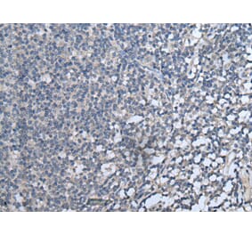 CXCL10 Antibody from Signalway Antibody (43715) - Antibodies.com