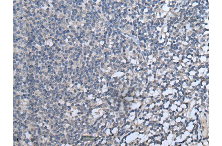 CXCL10 Antibody from Signalway Antibody (43715) - Antibodies.com