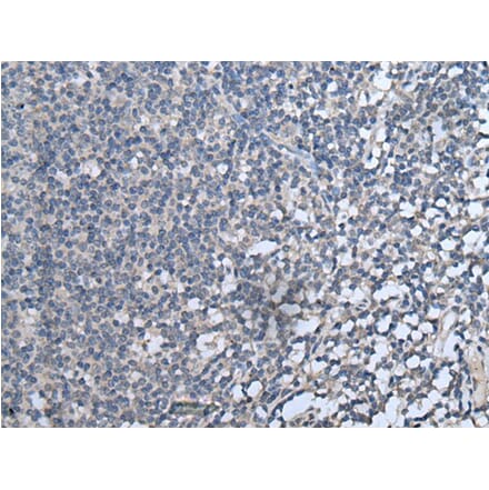 CXCL10 Antibody from Signalway Antibody (43715) - Antibodies.com