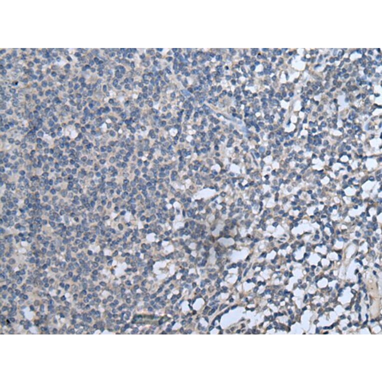 CXCL10 Antibody from Signalway Antibody (43715) - Antibodies.com