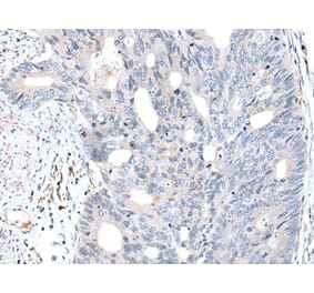 FABP12 Antibody from Signalway Antibody (43722) - Antibodies.com
