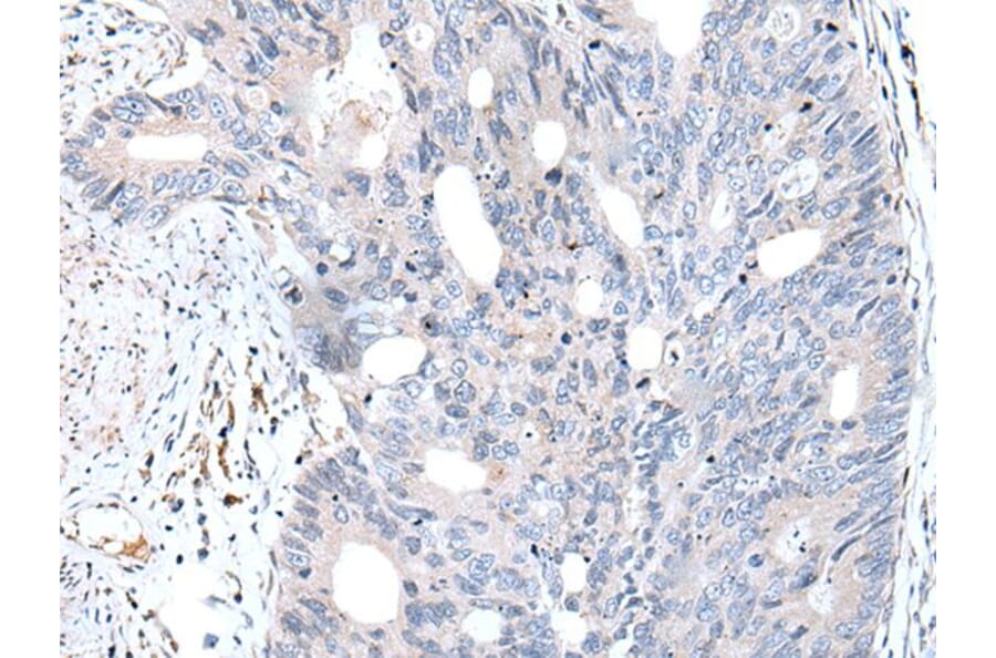 FABP12 Antibody from Signalway Antibody (43722) - Antibodies.com