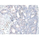 FABP12 Antibody from Signalway Antibody (43722) - Antibodies.com