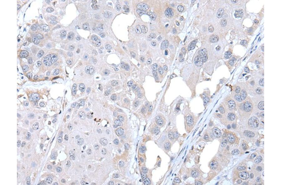 FABP12 Antibody from Signalway Antibody (43722) - Antibodies.com