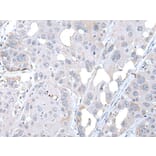 FABP12 Antibody from Signalway Antibody (43722) - Antibodies.com