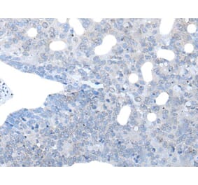 IGSF11 Antibody from Signalway Antibody (43736) - Antibodies.com