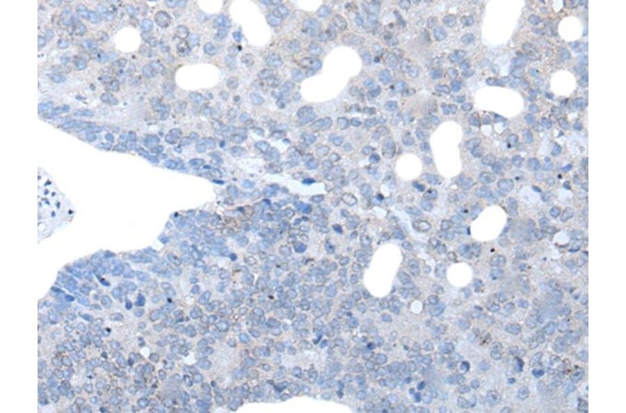 IGSF11 Antibody from Signalway Antibody (43736) - Antibodies.com