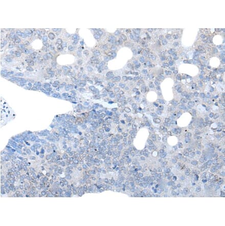 IGSF11 Antibody from Signalway Antibody (43736) - Antibodies.com