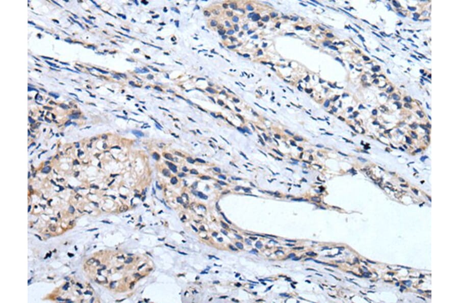 LINGO1 Antibody from Signalway Antibody (43744) - Antibodies.com