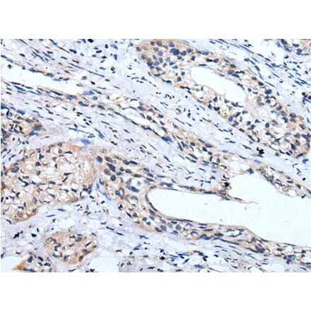 LINGO1 Antibody from Signalway Antibody (43744) - Antibodies.com