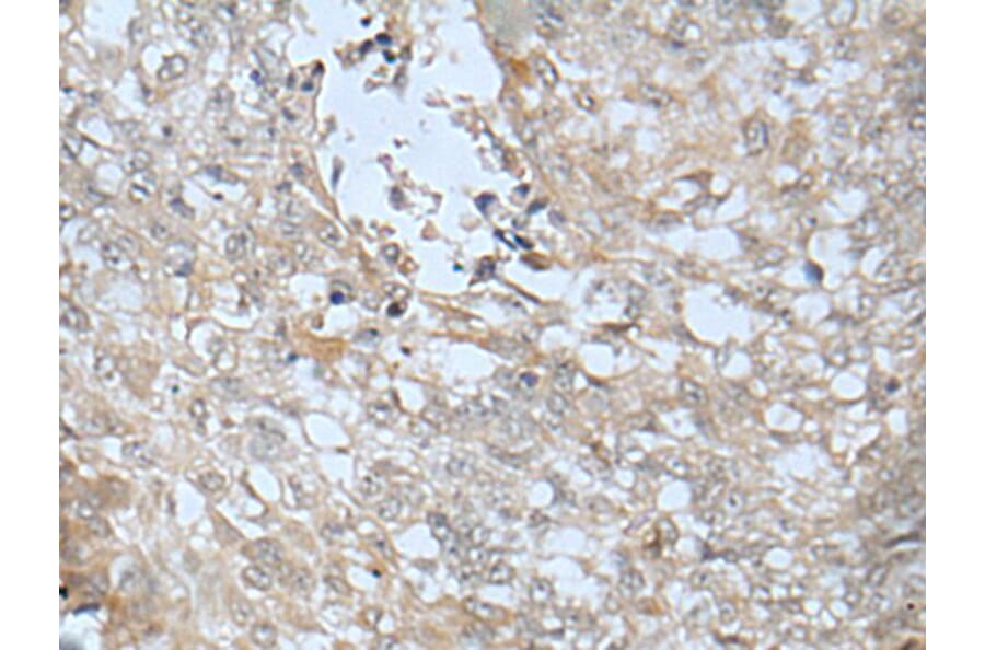 LRRC23 Antibody from Signalway Antibody (43748) - Antibodies.com