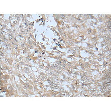 LRRC23 Antibody from Signalway Antibody (43748) - Antibodies.com