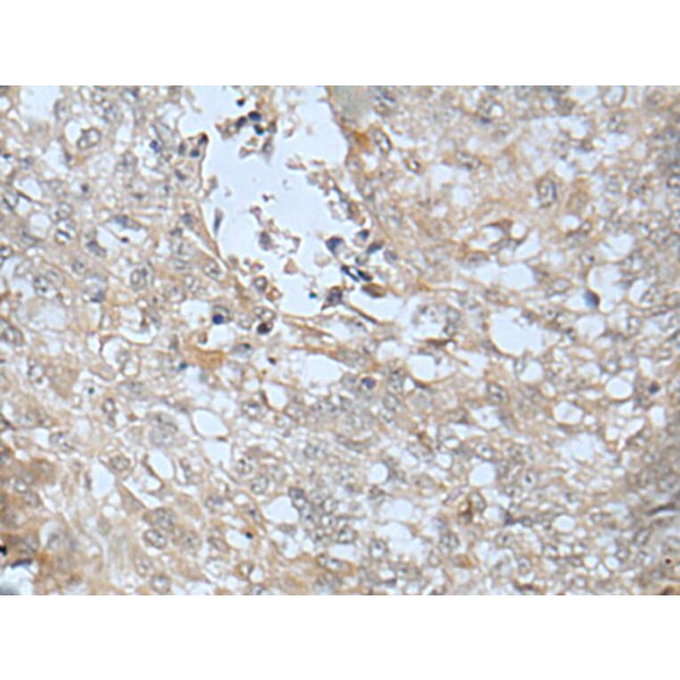 LRRC23 Antibody from Signalway Antibody (43748) - Antibodies.com