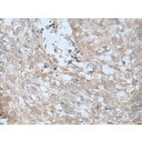 LRRC23 Antibody from Signalway Antibody (43748) - Antibodies.com