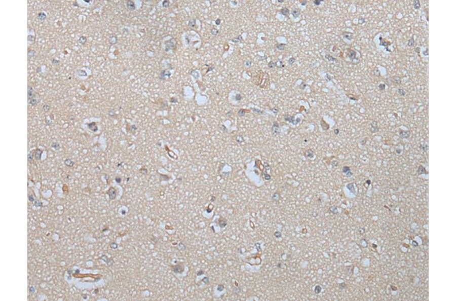 MAGEB5 Antibody from Signalway Antibody (43750) - Antibodies.com