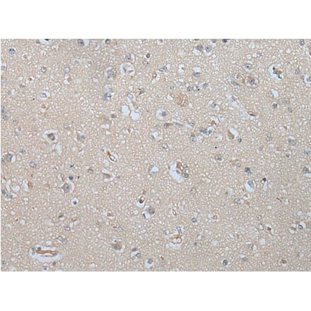 MAGEB5 Antibody from Signalway Antibody (43750) - Antibodies.com