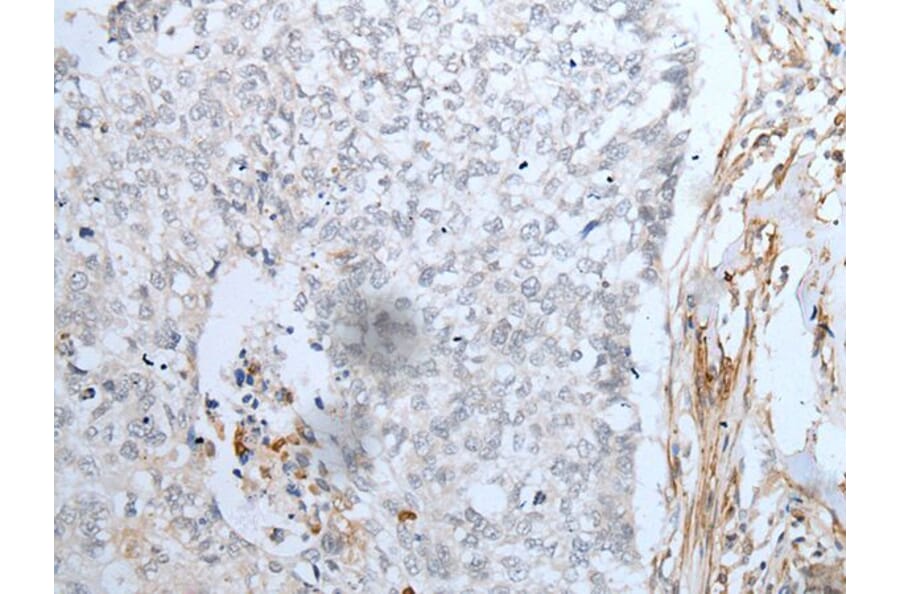 MAGEB5 Antibody from Signalway Antibody (43750) - Antibodies.com