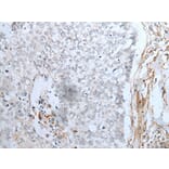 MAGEB5 Antibody from Signalway Antibody (43750) - Antibodies.com