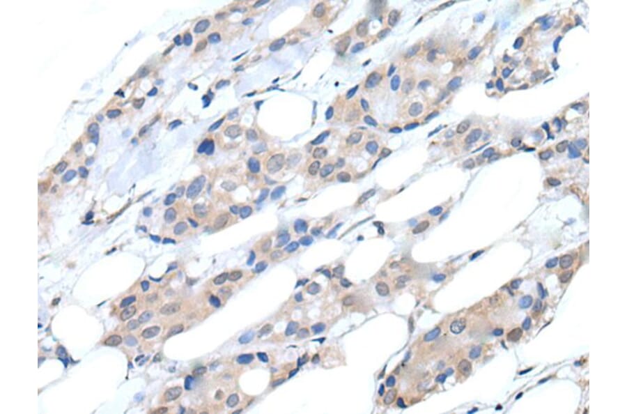 PIK3CA Antibody from Signalway Antibody (43766) - Antibodies.com